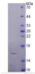 SDS-PAGE (DRD1-15H).jpg